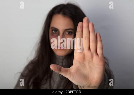 Abused woman with a bruised black eye calling a halt to domestic violence holding up her hand in a stop gesture with focus to her hand Stock Photo