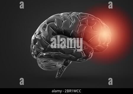 Brain inflammation or other process associated with tissues damage or thinking Conceptual 3d illustration helpful for in visualizing brain diseases. Stock Photo