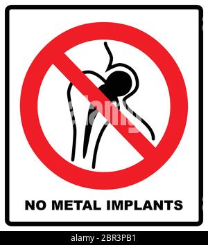 No metallic articles or watches, No access for people with metallic implants signs. Vector illustration. Warning symbol isolated on white Stock Vector