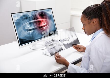 Female Dentist Examining Teeth X-ray On Computer Over Desk In Clinic Stock Photo