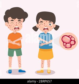 Children has chicken pox infographic, Poster children fever and chickenpox symptoms and prevention. Health care and medical  cartoon character vector Stock Vector