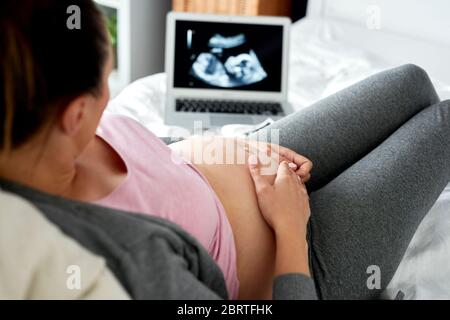 Pregnant woman watching ultrasound record on computer Stock Photo