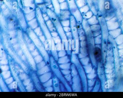 Plant material (stained) from a garden water sample, likely sphagnum moss, under the microscope; filed of view is about 1.2mm wide Stock Photo