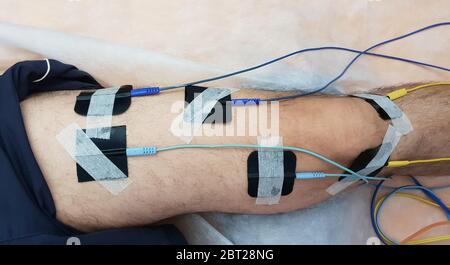 Electrostimulation of the quadriceps as a physiotherapy therapy Stock Photo