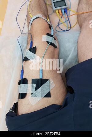 Electrostimulation of the quadriceps as a physiotherapy therapy Stock Photo