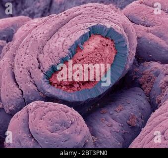 Small intestine. Coloured scanning electron micrograph (SEM) of a freeze-fractured of the small intestine. The surface consists of deep folds, called Stock Photo