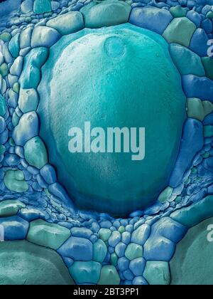 Skin. Coloured scanning electron micrograph of a section through the ...