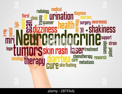 Neuroendocrine tumors word cloud and hand with marker concept on white background. Stock Photo