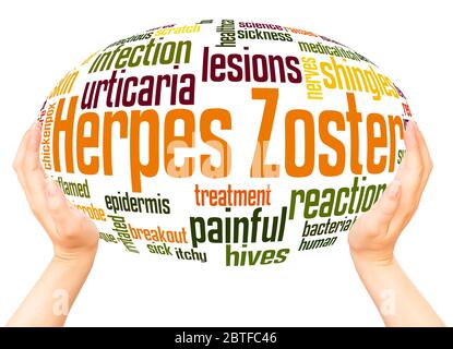 Herpes zoster word hand sphere cloud concept on white background. Stock Photo