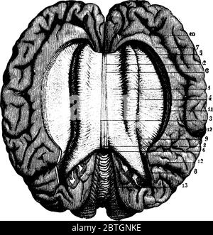 Diagram of transverse section of middle part of brain showing lateral ...