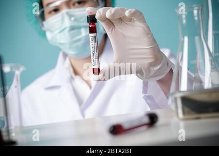 Doctor holding testing patients blood samples for Coronavirus Outbreak (COVID-19) in the laboratory, New coronavirus 2019-nCoV from Wuhan China concep Stock Photo