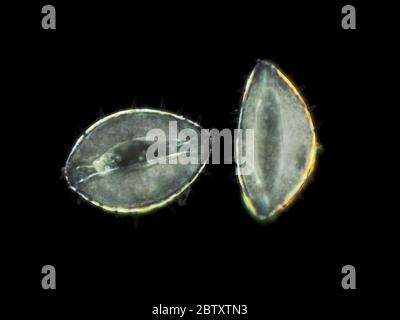 Dark field light micrograph of yellow pond lily (Nuphar polysepala) pollen grains, pictured area is about 160 micrometers wide Stock Photo