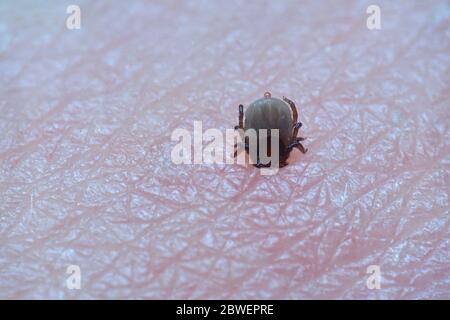 Super close up of sucking Ixodes ricinus on human skin. Adults feed on large mammals such as sheep, cattle, dogs, deer, humans, and horses for 6–13 da Stock Photo