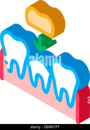 Stomatology Tooth Crown isometric icon vector illustration Stock Vector ...