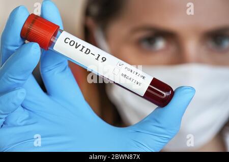 Hand in blue gloves holding vial with blood, label says covid-19 test, positive result, blurred woman in white mouth mask face background. Coronavirus Stock Photo