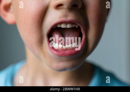 Crop view of little boy showing his milk teeth Stock Photo