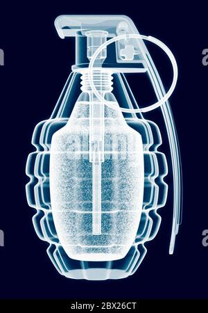 Grenade X ray, explosive, terrorism, security. Plain background. Cut out. Pineappleweapon Stock Photo