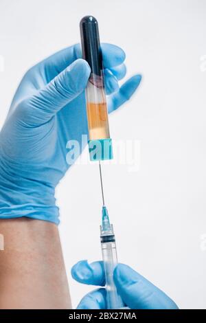Vertical image format - Plasma lifting - close-up of a doctor's hand in blue rubber gloves with a syringe Stock Photo