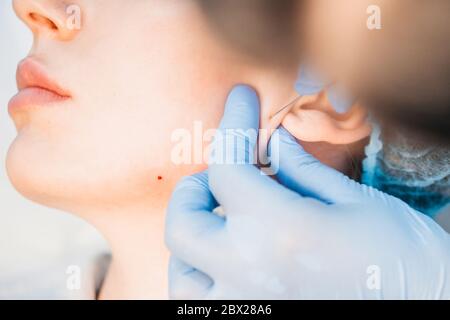 The procedure for the introduction of the active substance - under the skin, in pre-marked areas, injections of gualuronic acid are made - an ultrafin Stock Photo