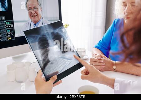 Physician checking lungs x-ray of senior woman when looking for evidence of pneumonia and video calling colleague Stock Photo