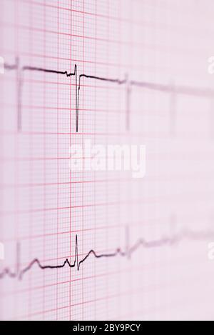 ECG graph Stock Photo