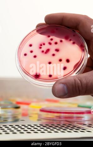 Bacterial colonies culture on Differential and Selective media. Biotechnology, health. Stock Photo