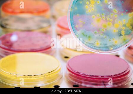 Bacterial colonies culture on Differential and Selective media. Biotechnology, health. Stock Photo