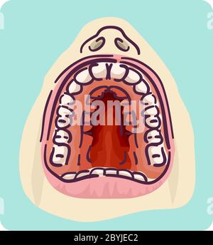 Illustration of a Wide Opened Mouth with High Arched Palate and Crowded Teeth Stock Photo