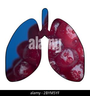 A collage closeup of a pomegranate simulating the lungs of a sick person. Stock Photo