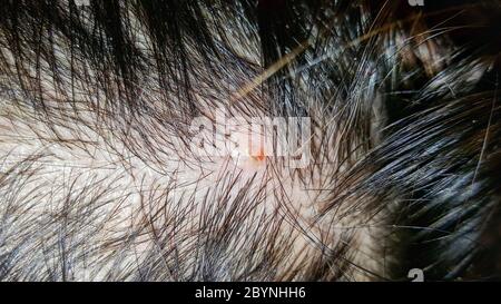 abscess on skin head Stock Photo