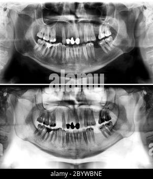PANORAMIC RADIOLOGY SECOND EDITION 歯列矯正 PANORAMIC RADIOLOGY