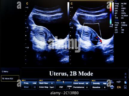 Colourful Ultrasound Monitor Image 2d Steer Stock Photo Alamy