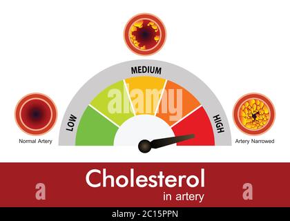 Cholesterol in artery, health risk , vector design Stock Vector