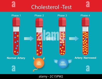 Cholesterol in artery, health risk , Levels of cholesterol, vector design Stock Vector