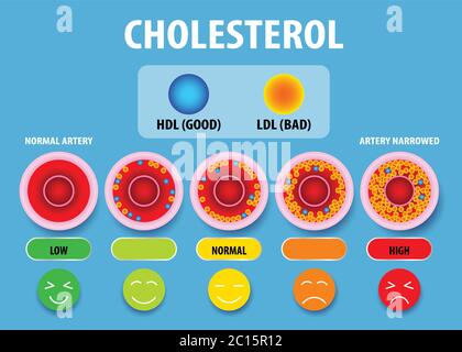 Cholesterol in artery, health risk , vector design Stock Vector