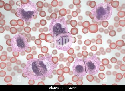 3d illustration of the strong increase of non-functional white blood cells called leukemia cells leading to blood cancer disease Stock Photo