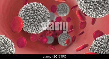3d illustration of the strong increase of non-functional white blood cells called leukemia cells leading to blood cancer disease Stock Photo