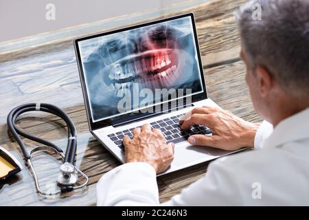 Close-up Of A Dentist's Hand Examining Teeth X-ray On Laptop Stock Photo