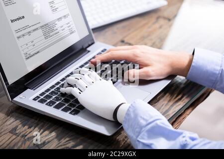 Man With Prosthetic Hand Working On Laptop. Artificial Limb Stock Photo