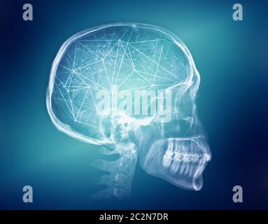 Human skull X-ray image. Artificial intelligence futuristic concept Stock Photo