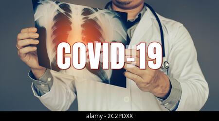 The doctor was carrying an x-ray picture and looking at the lung infection new rapidly spreading Coronavirus (Covid-19) concept.