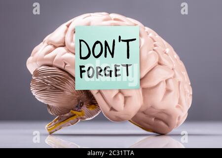 Adhesive Note With Don't Forget Text Stuck On Brain Model Over Reflective Desk Stock Photo