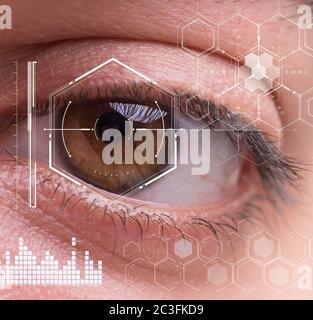 Concept of sensor implanted into human eye Stock Photo