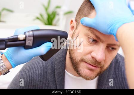 Fractional laser procedures in the clinic. Stock Photo