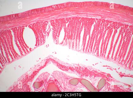 Lumbricus, transverse section through Typhlosole Stock Photo