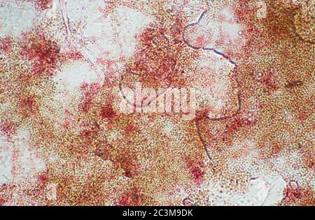 penicillium roqueforti microscope