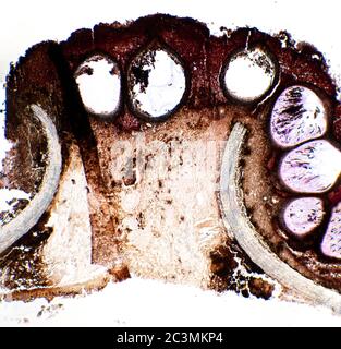 Xylaria Fungi round Perithecia on Hazel bark, microscope view Stock Photo