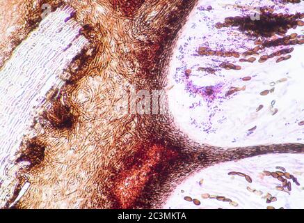 Xylaria Fungi round Perithecia on Hazel bark, microscope view Stock Photo