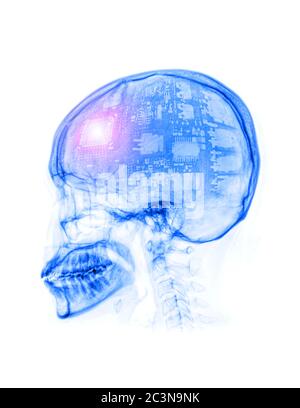 Intellectual thinker , Human skull x-ray with CPU for technology concept isolated on white Background. Stock Photo