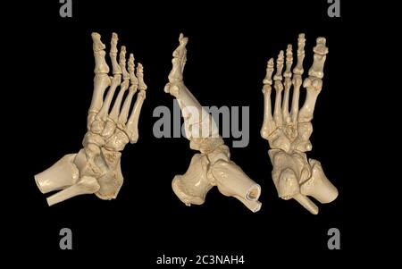 CT Scan of Right Foot 3D rendering image  AP , Lateral and bottom view .medical technology concept. Stock Photo